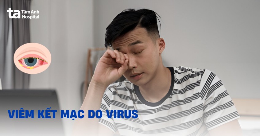 Viêm kết mạc do virus: Nguyên nhân, dấu hiệu và cách điều trị