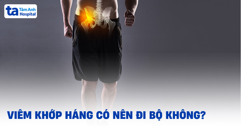 Viêm khớp háng có nên đi bộ không? Người bệnh cần lưu ý gì?