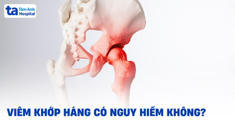 Viêm khớp háng có nguy hiểm không? Một số biến chứng thường gặp