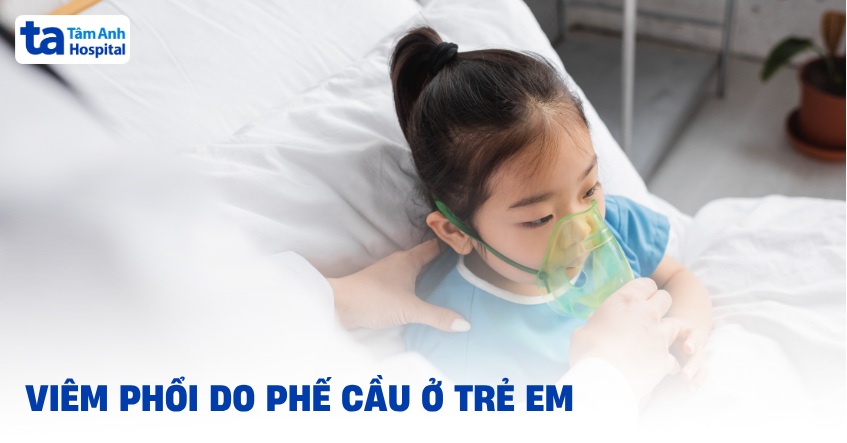 Viêm phổi do phế cầu ở trẻ em: Nguyên nhân và cách điều trị bệnh