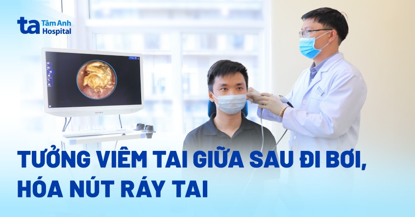 viêm tai giữa sau đi bơi hóa nút ráy tai