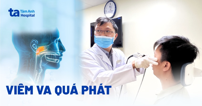 Viêm VA quá phát: Nguyên nhân, triệu chứng và phòng ngừa