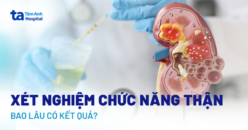Xét nghiệm chức năng thận bao lâu có kết quả? Các yếu tố ảnh hưởng