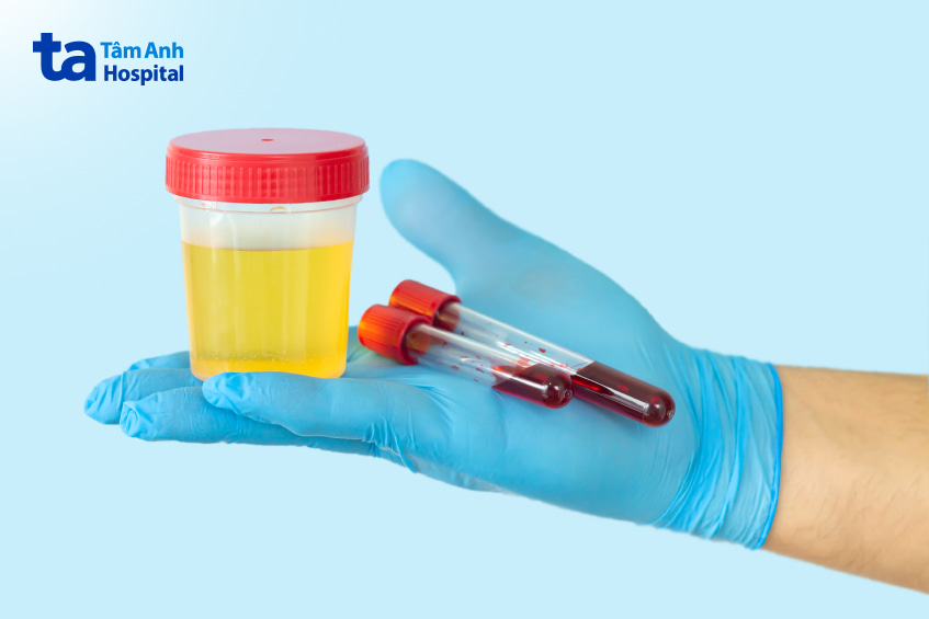 Xét nghiệm máu kiểm tra chức năng thận