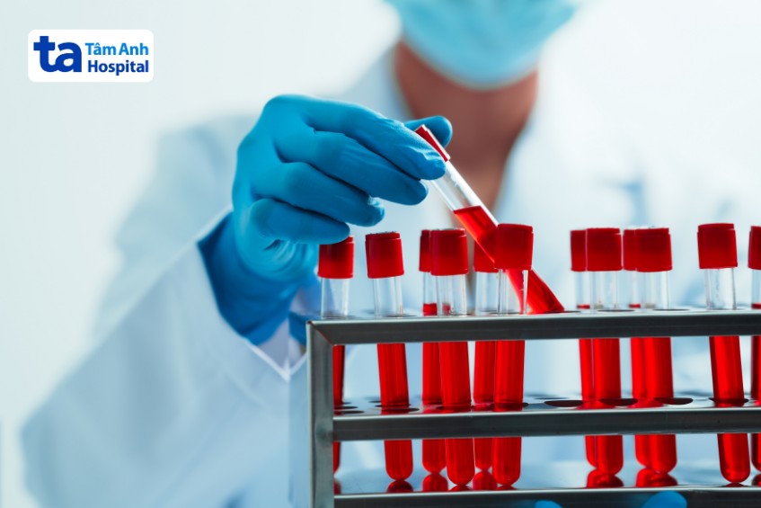 xét nghiệm máu cụ thể tùy trường hợp