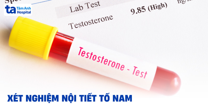 Xét nghiệm nội tiết tố nam gồm những gì? Quy trình thực hiện