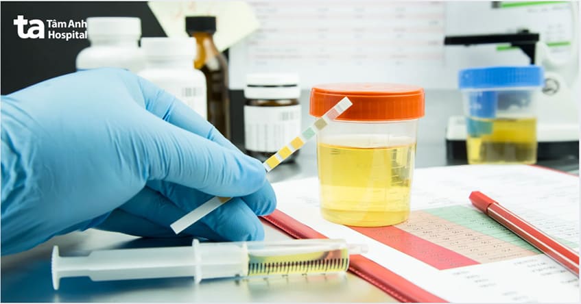 xét nghiệm nước tiểu