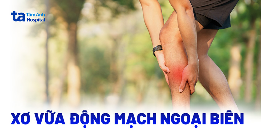 Xơ vữa động mạch ngoại biên là gì?