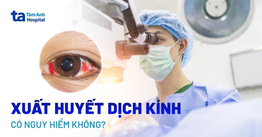 xuất huyết dịch kính có nguy hiểm không