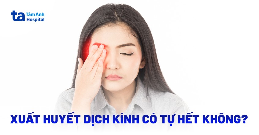 Xuất huyết dịch kính có tự hết không? Cách giảm nguy cơ mắc bệnh