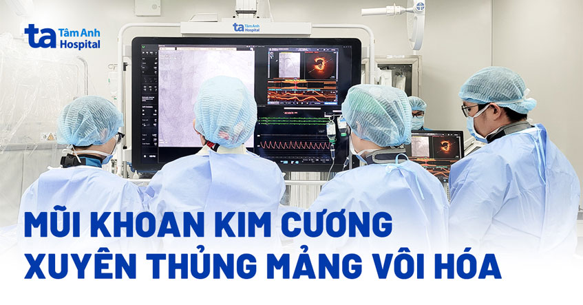 Xuyên thủng mảng vôi hóa mở rộng ba nhánh mạch vành
