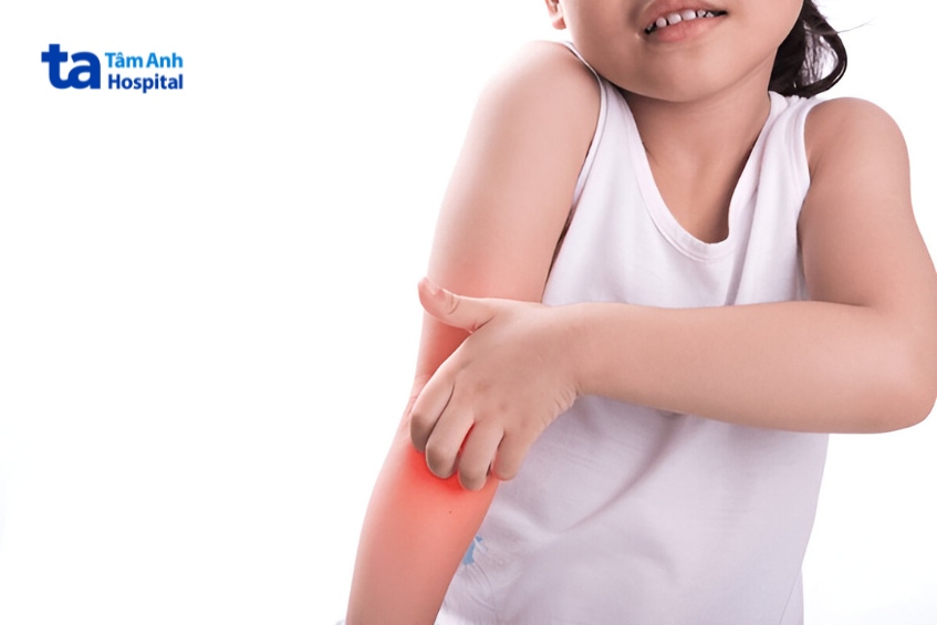 yếu tố ảnh hưởng đến kết quả điều trị bệnh của bé