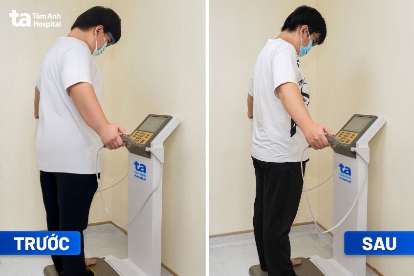 Kết quả khi áp dùng liệu trình giảm cân tại Tâm Anh