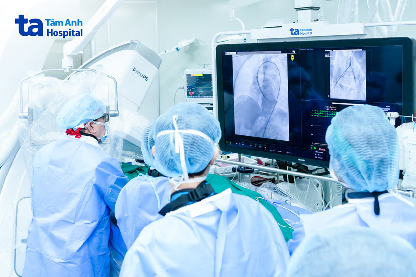 Các bác sĩ can thiệp thay van động mạch chủ qua ống thông cho bệnh nhân