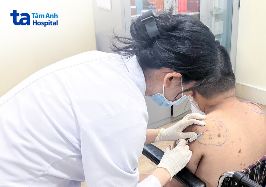 bác sĩ tiêm trị sẹo lồi cho bé