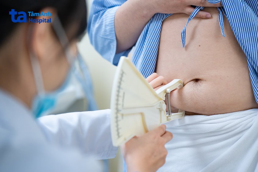 bác sĩ đang đo lượng mỡ dưới da