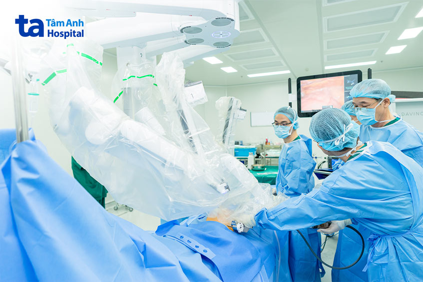 Bác sĩ Dũng điều khiển cánh tay robot, phối hợp cùng ê kíp phụ mổ loại bỏ khối u cho bệnh nhân