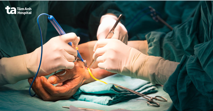 bác sĩ thực hiện tiểu phẫu