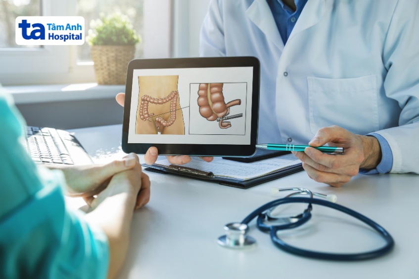 bác sĩ tư vấn về ruột thừa