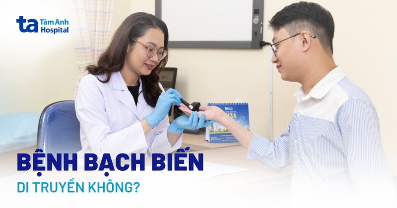 Bệnh bạch biến có di truyền không? Tỉ lệ con mắc bệnh là bao nhiêu?