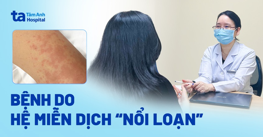 bệnh do hệ miễn dịch nổi loạn
