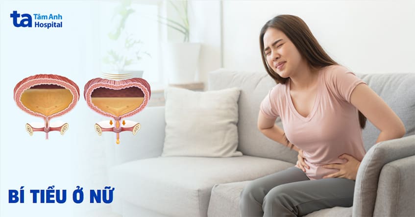 Bí tiểu ở nữ giới: Nguyên nhân, triệu chứng và cách điều trị