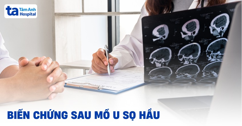11 biến chứng sau mổ u sọ hầu có thể gặp và cách hạn chế, khắc phục