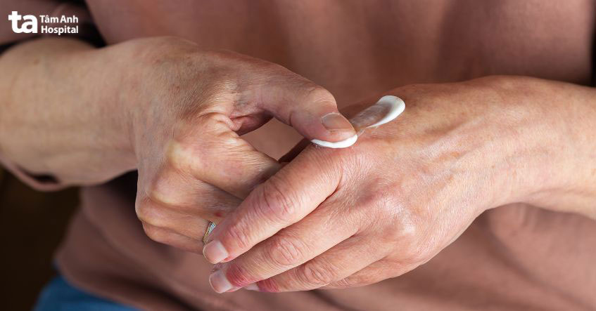 bôi thuốc để ngăn nhiễm trùng