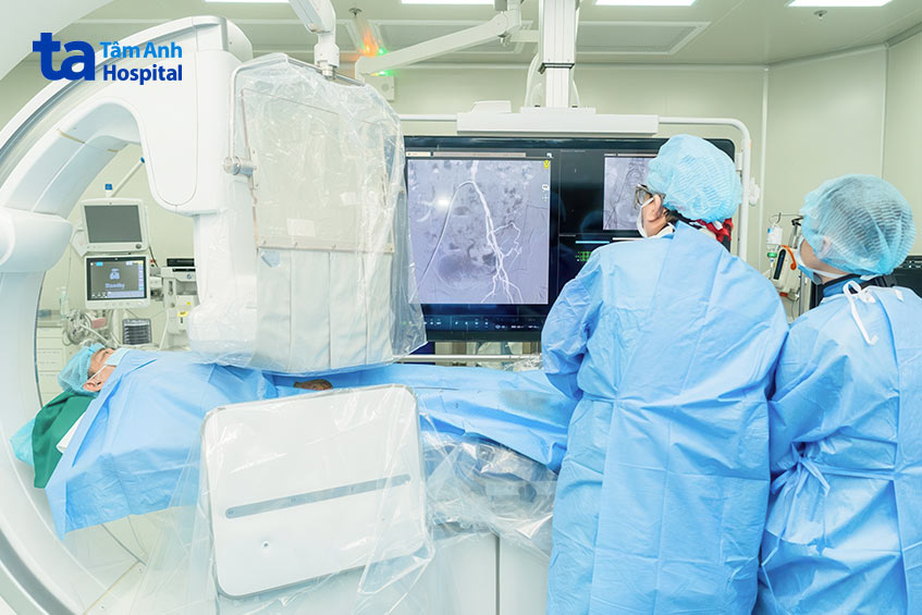 Bác sĩ can thiệp nong mạch đặt stent động mạch chậu cho bệnh nhân