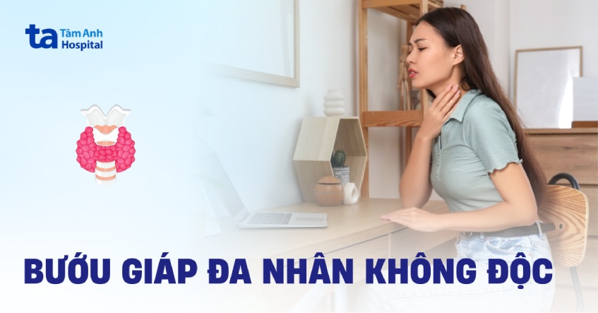 Bướu giáp đa nhân không độc: Nguyên nhân, triệu chứng, điều trị