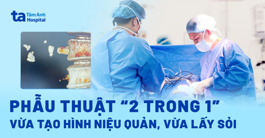 Phẫu thuật “2 trong 1” vừa tạo hình niệu quản, vừa lấy sỏi