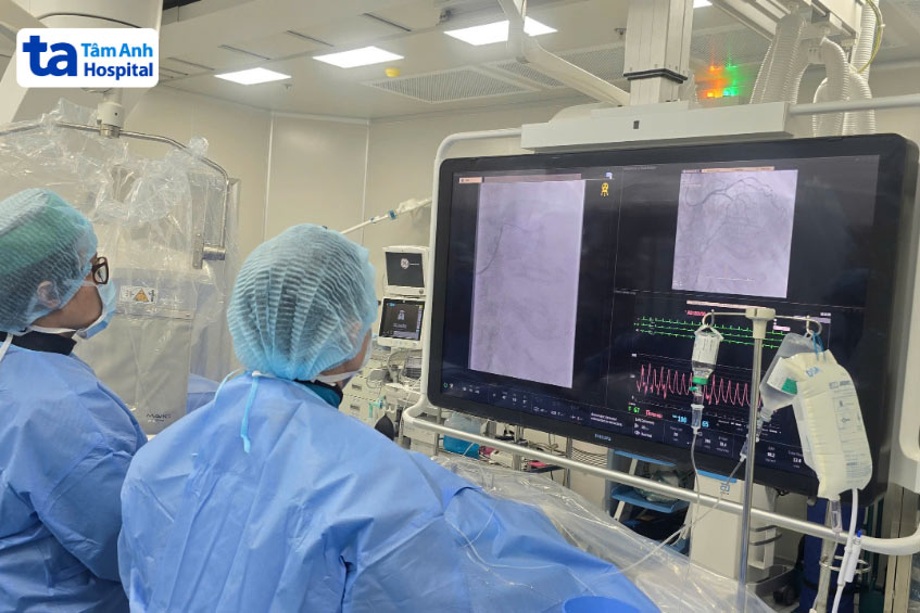 Các bác sĩ tiến hành nong mạch vành bị hẹp cho bệnh nhân