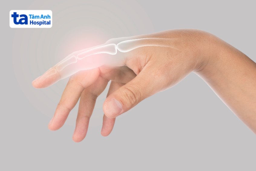 Các loại chấn thương ngón tay