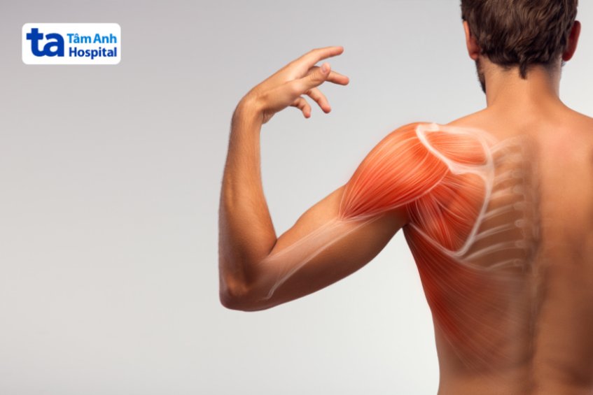 Các loại chấn thương vai khi tập gym