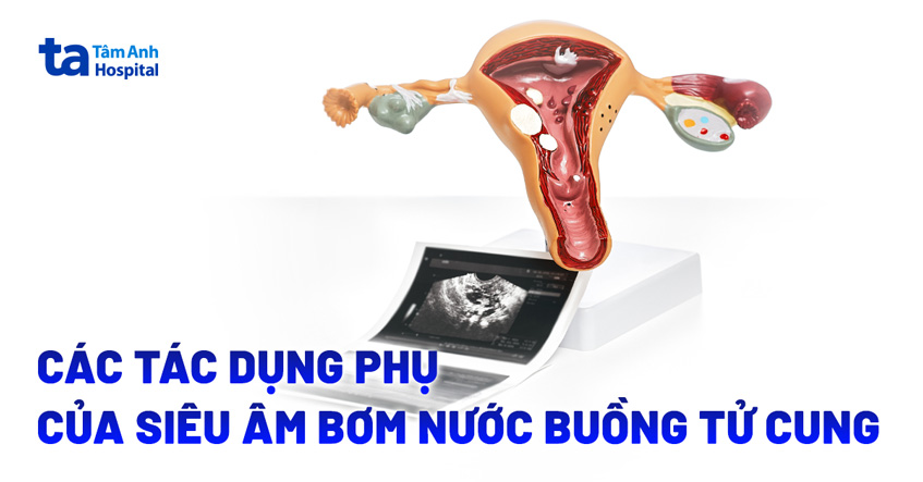 8 tác dụng phụ của siêu âm bơm nước buồng tử cung có thể gặp