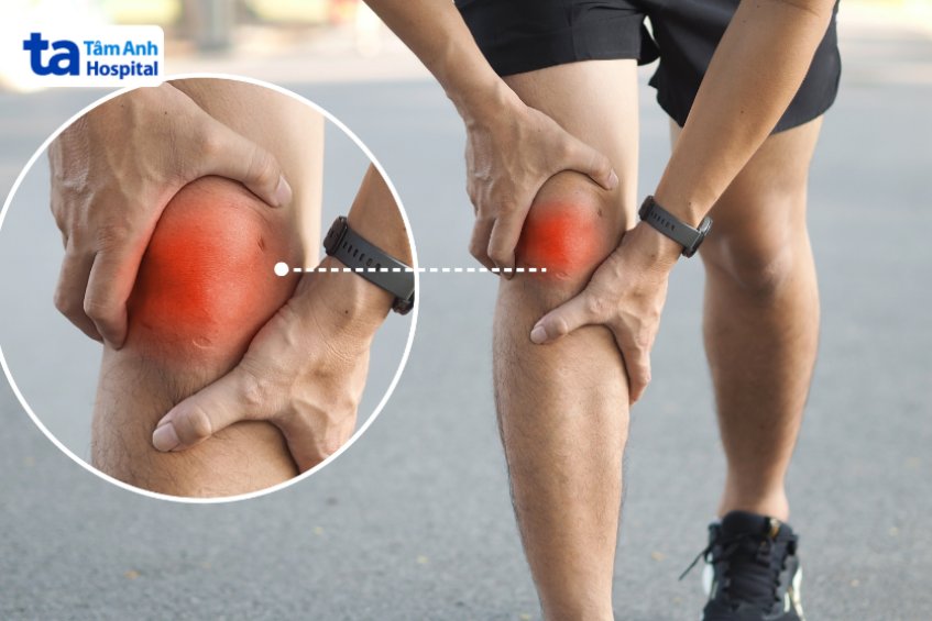 Các triệu chứng đi kèm sốt do viêm khớp