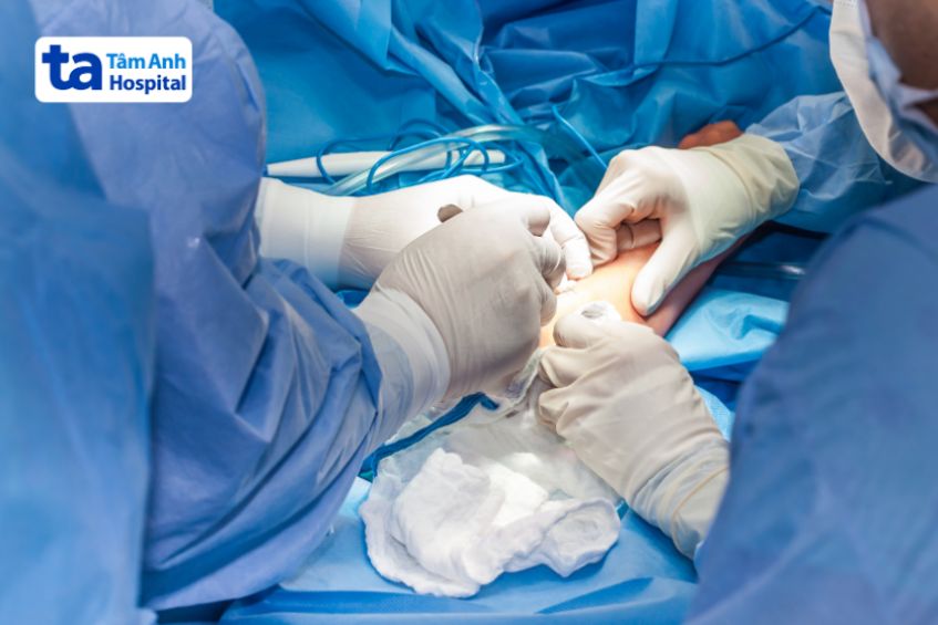 Cách điều trị hội chứng Tennis Elbow