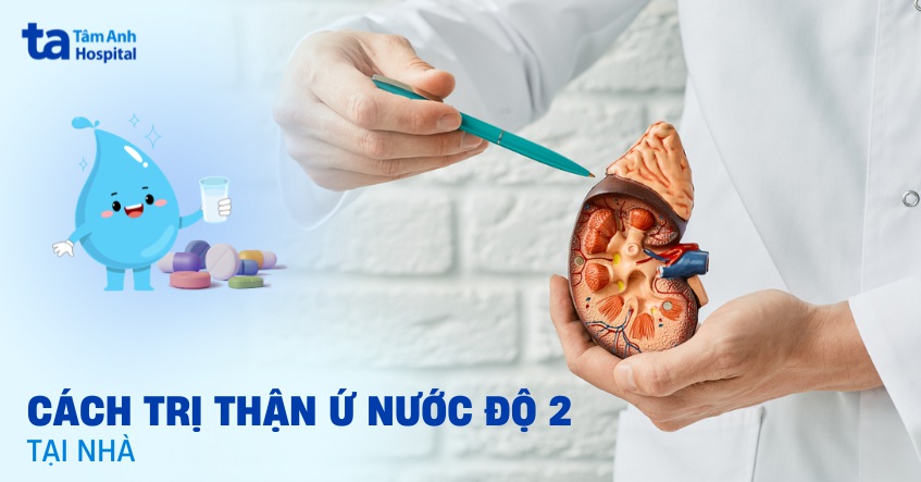 7 cách trị thận ứ nước độ 2 tại nhà giảm triệu chứng hiệu quả