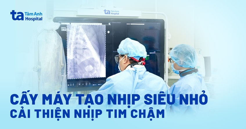 Cải thiện nhịp tim chậm bằng máy tạo nhịp siêu nhỏ