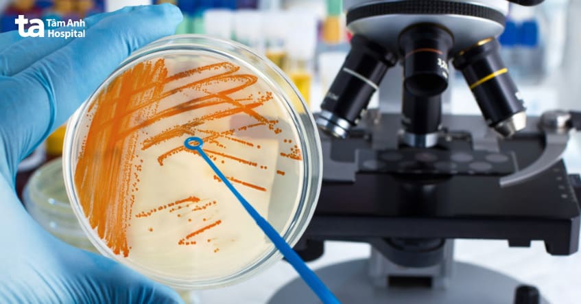 chẩn đoán bằng cách xét nghiệm nuôi cấy nước tiểu