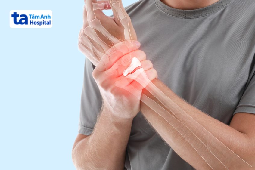 Chấn thương cổ tay có nguy hiểm không?