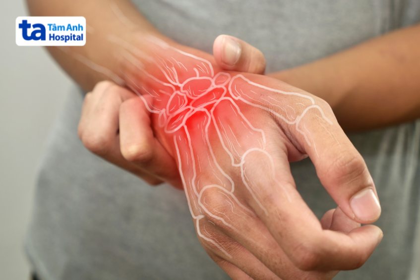 Hiện tượng chấn thương ở vùng cổ tay