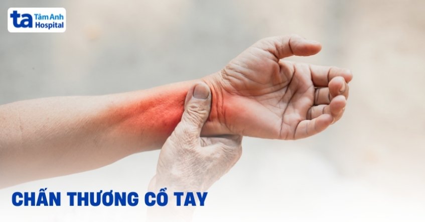 Chấn thương cổ tay