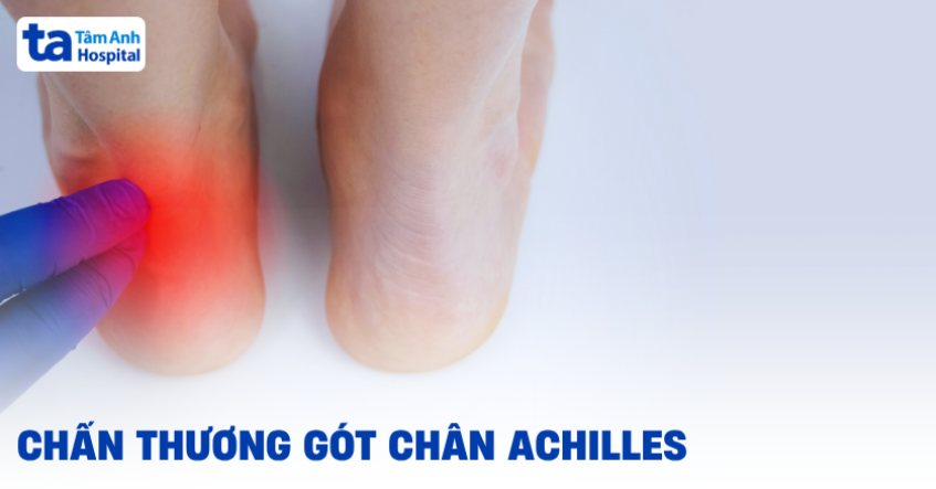Chấn thương gót chân achilles