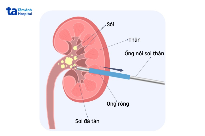 chỉ định chống chỉ định