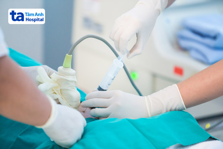 chọc ối để chẩn đoán thiếu máu fanconi