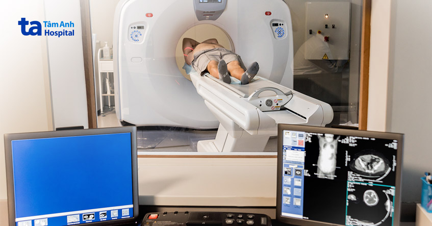 chụp cắt lớp vi tính