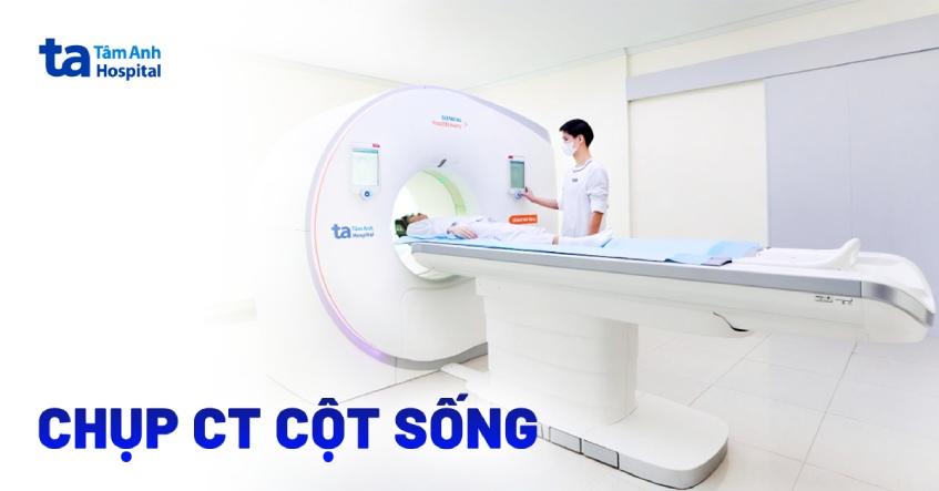 Chụp CT cột sống: Ưu nhược điểm và quy trình thực hiện