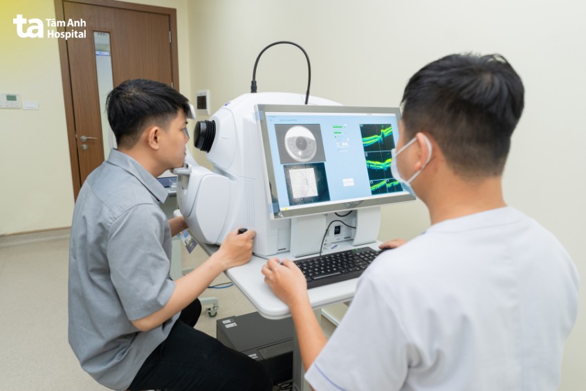 chụp oct giúp quan sát cấu trúc võng mạc