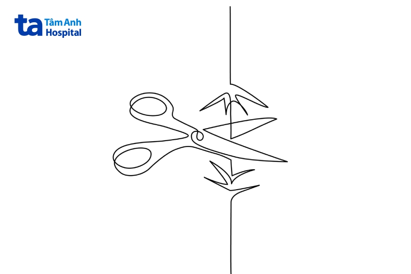 có nên cắt dây hãm quy đầu